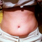fatbelly
